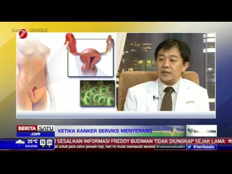 Video: Pusing Dengan Osteochondrosis Serviks - Pengobatan, Penyebab