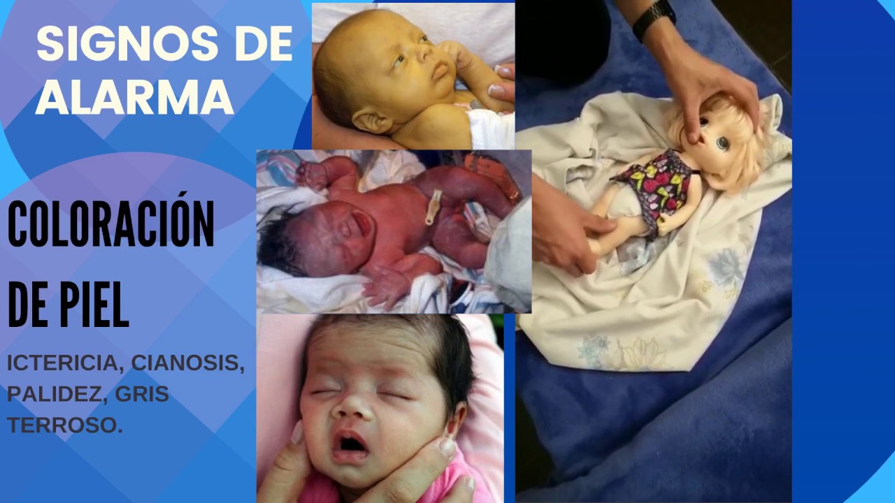 CESAR.VIDEO5 "TEMA INFOGRAFIA: SIGNOS DE ALARMA DEL RECIÉN NACIDO