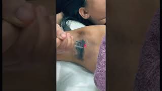 “From dull to flawless — underarm care that works” #underarmwhitening #facialaesthetics #skincare