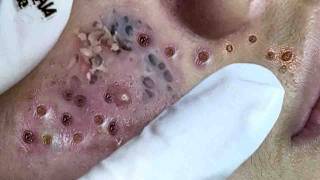 𝑳𝒖𝒙𝒖𝒓𝒚 𝑭𝒂𝒄𝒊𝒂𝒍 𝑬𝒔𝒄𝒂𝒑𝒆 𝑭𝒐𝒓 𝑫𝒆𝒆𝒑 𝑹𝒆𝒍𝒂𝒙𝒂𝒕𝒊𝒐𝒏 𝒂𝒏𝒅 𝑰𝒏𝒏𝒆𝒓 𝑷𝒆𝒂𝒄𝒆 #117211