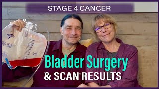 Living with Stage 4 Cancer / BLADDER SURGERY EXPERIENCE & SCAN RESULTS by The Dan & Annie Show: Crazy Cancer & Nomad Life 625 views 1 year ago 11 minutes, 38 seconds