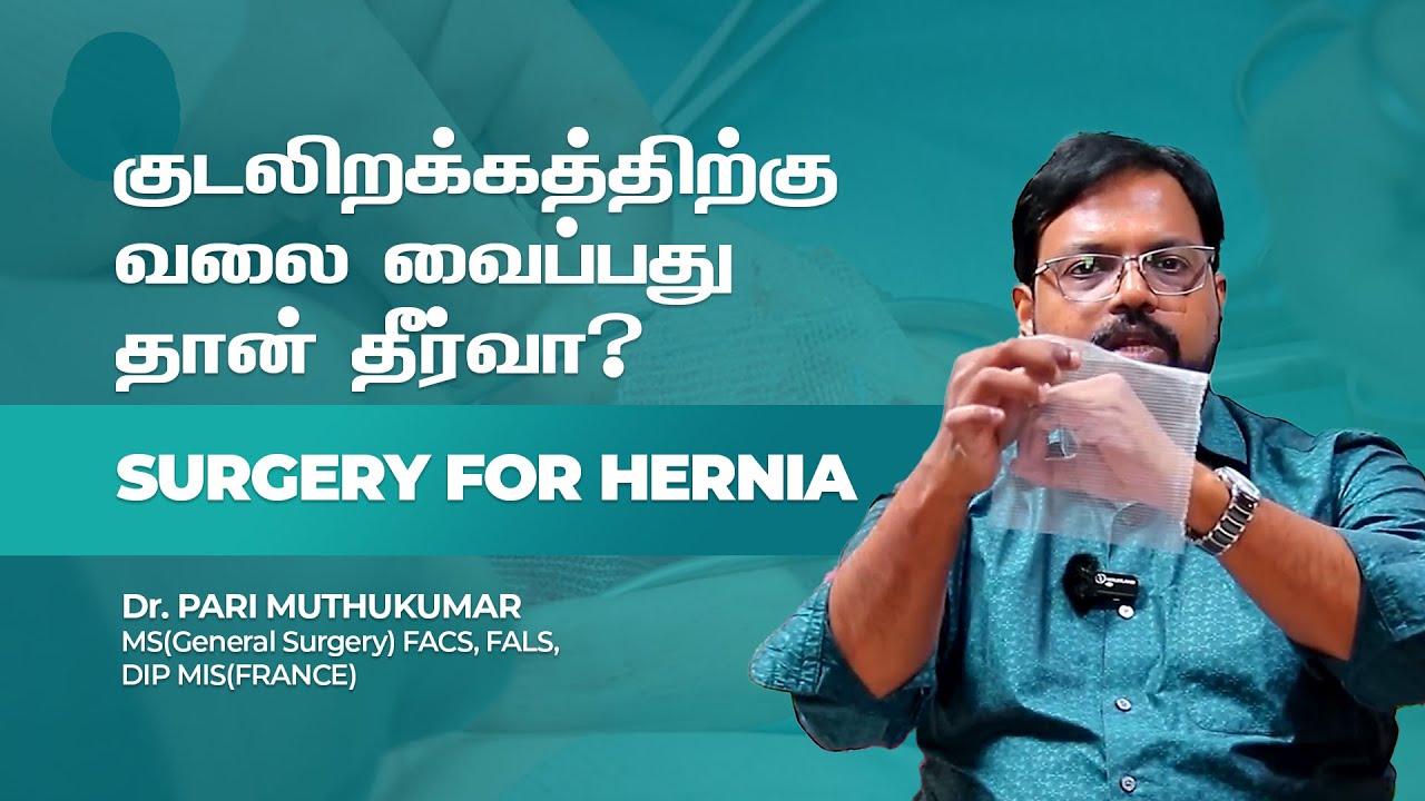 Hernia surgery and recovery tamil | ஹெர்னியாவுக்கு வலை தேவையா ? | Laparoscopic Surgery