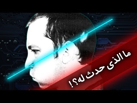 ماذا لو أدخلت رأسك في جهاز مسرع الجسيمات