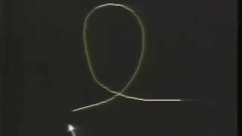 snakes - Active Contour Model