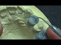 Live wax up - Upper 1st premolar(full)