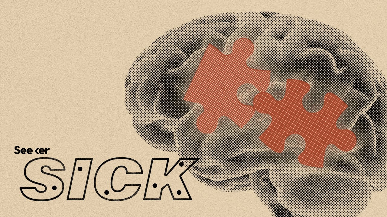 What Does Alzheimer’s Do to the Human Brain?
