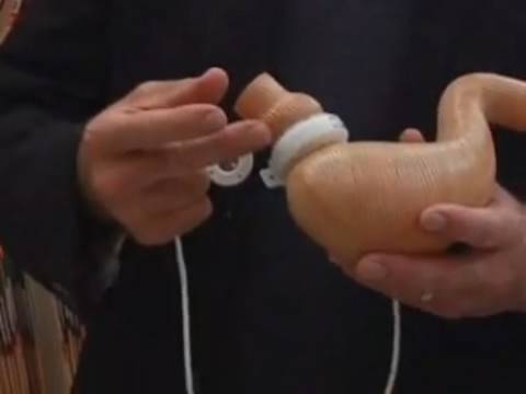 Lap Band Surgery