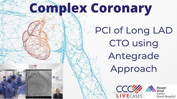 PCI of Long LAD CTO using Antegrade Approach
