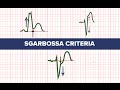 Sgarbossa criteria  medzcool