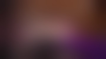 Intravitreal Brolucizumab (novartis antivegf) in the eye