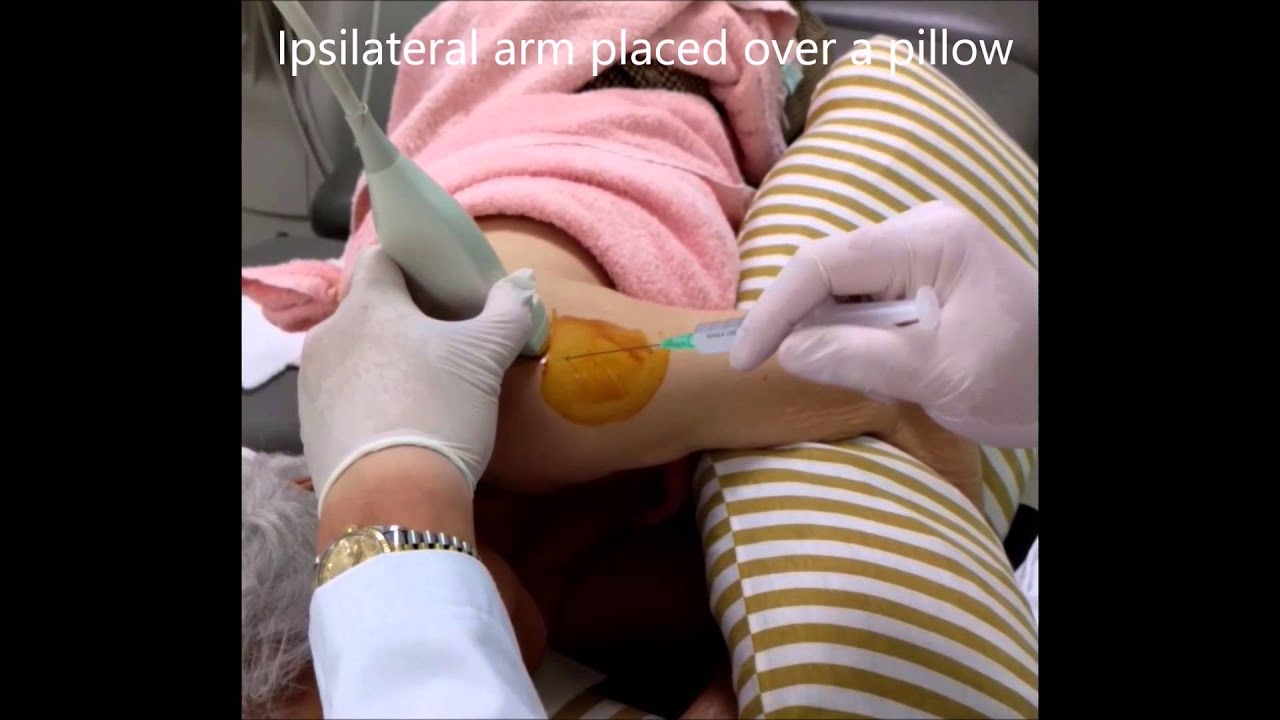 Us Guided Gh Inj Ultrasound-Guided Glenohumeral Joint Injection - YouTube