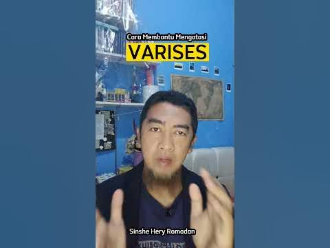 cara membantu mengatasi varises #varises #infosehat #infokesehatan