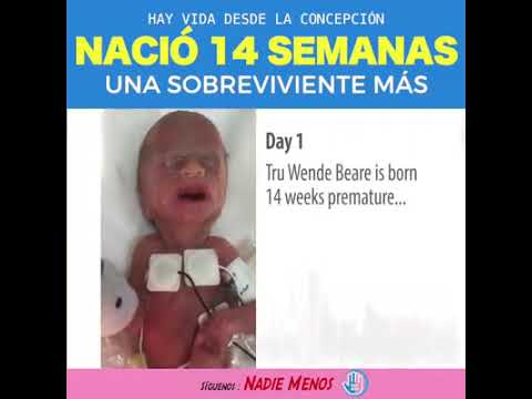 Bebe de 15 semanas sobrevive