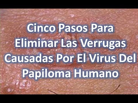 verrugas del virus del papiloma humano fotos