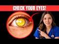 What Your Eyes Are Saying About Your Health: Doctor Explain