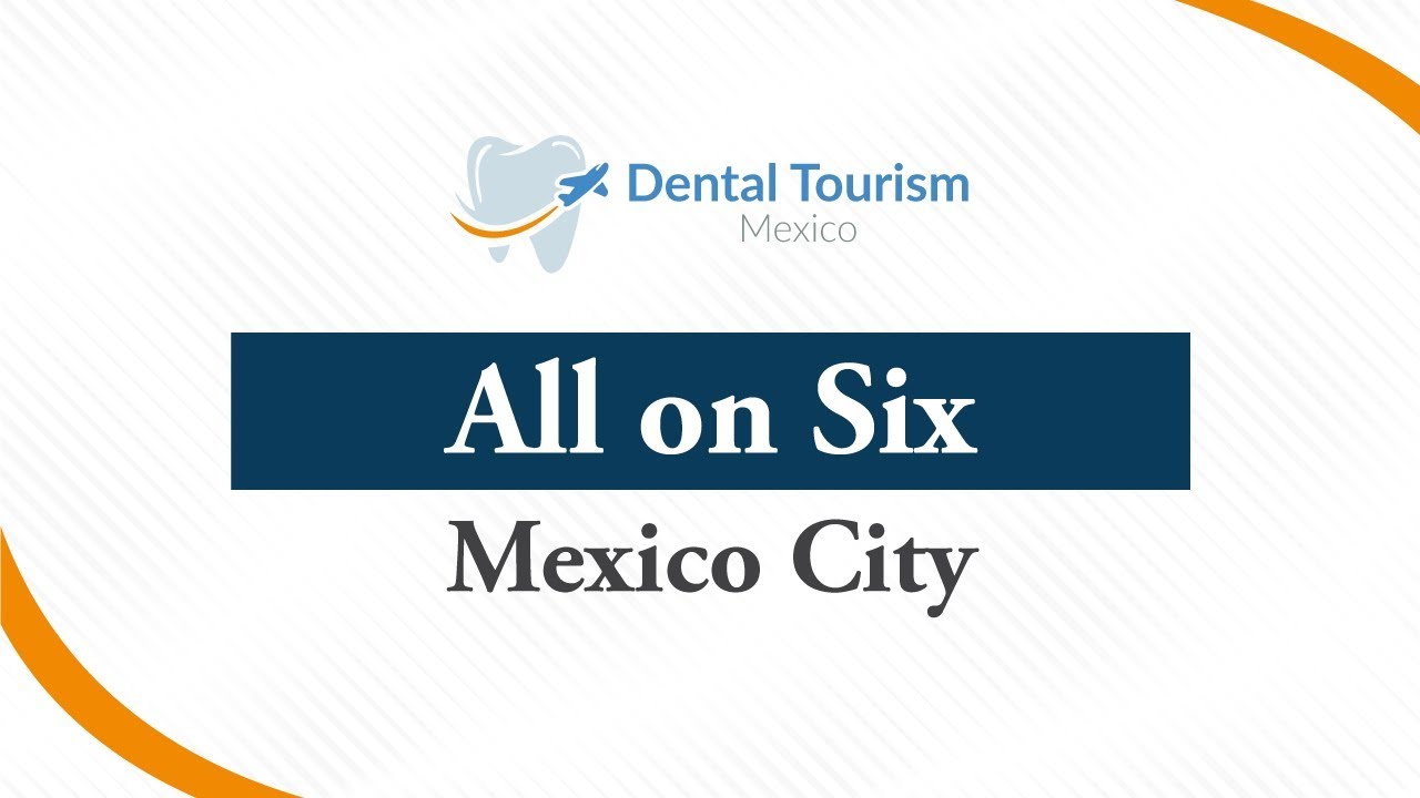 All on Six Dental Implants - Mexico City