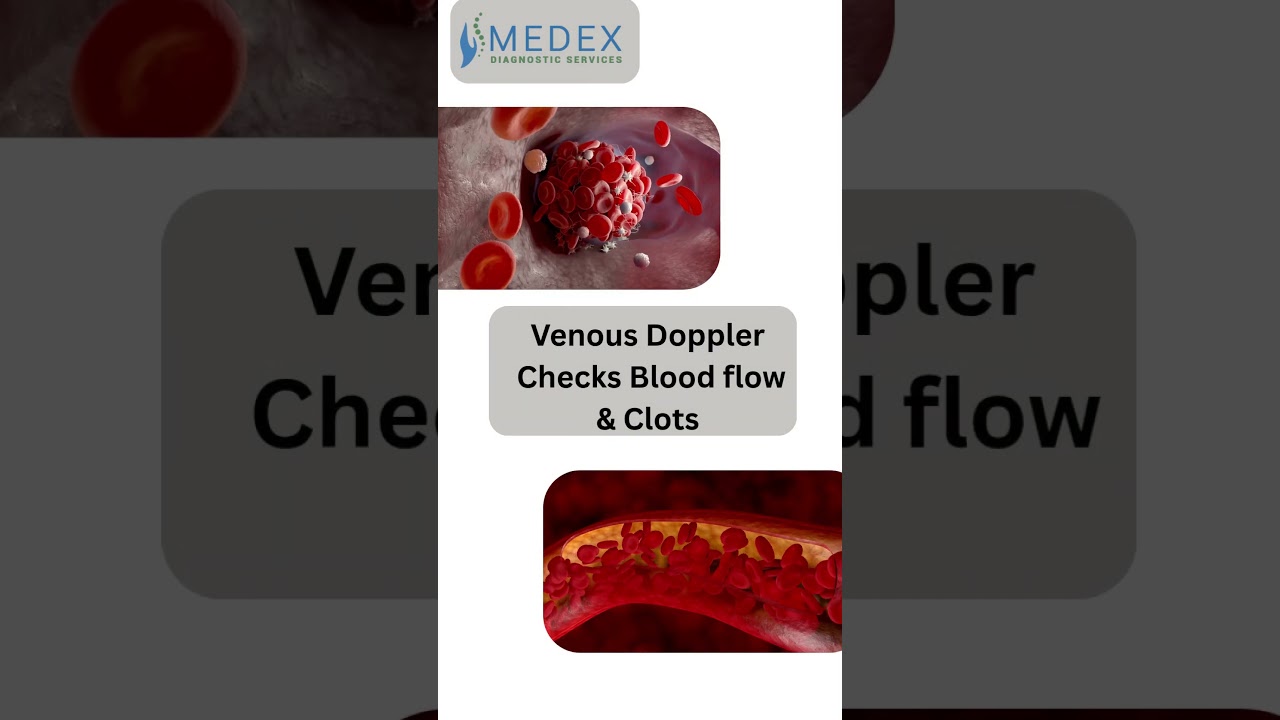 Swollen Legs? It Could Be More Than Just Fatigue || Medex Diagnostics