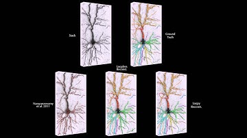 Automated Loopy Reconstruction in a Brightfield Micrograph