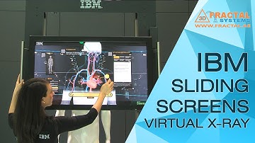 Sliding screens - Virtual X-Ray - IBM