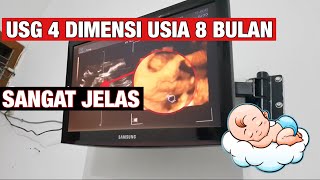 USG 4 Dimensi ( 4D ) Kandungan 8 Bulan .. Wajah bayi terlihat jelas