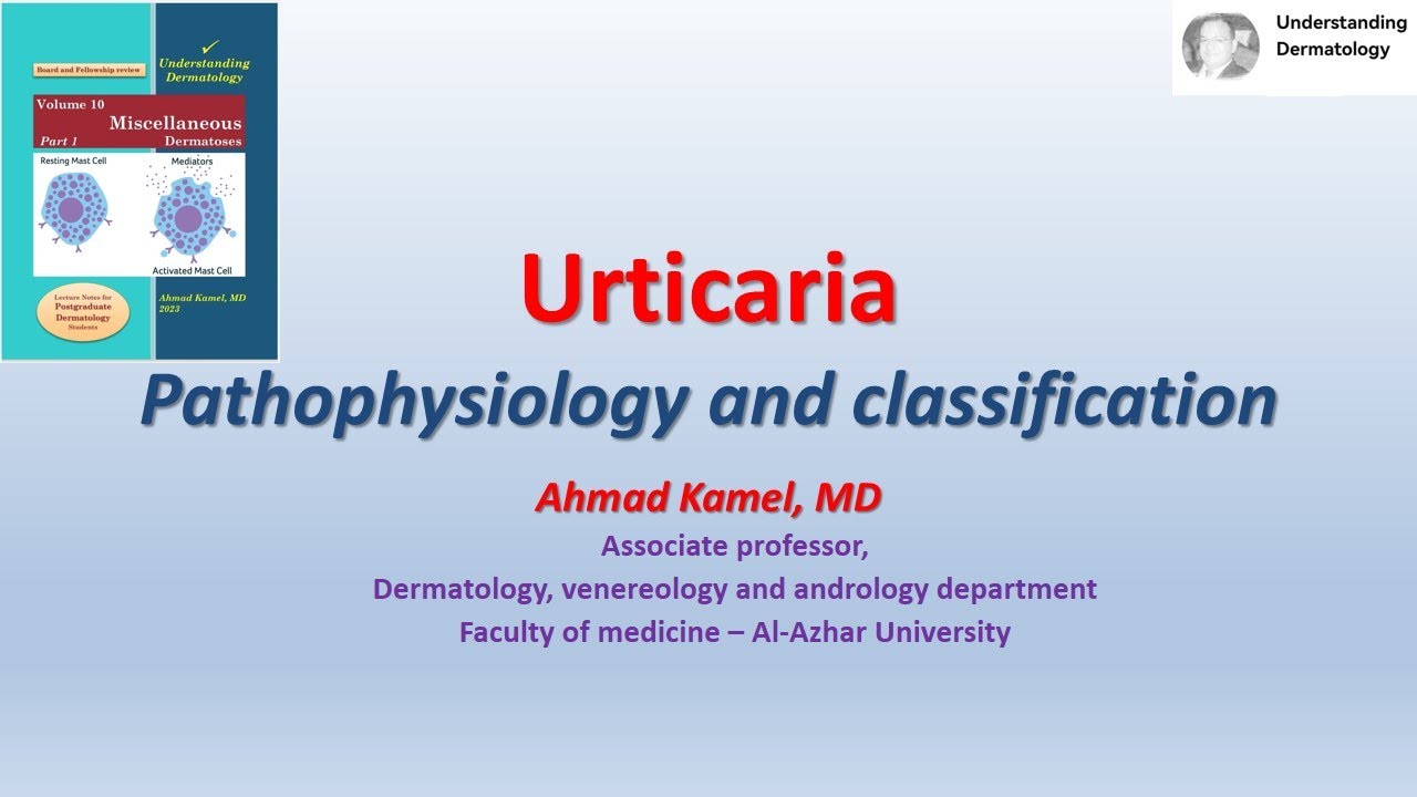 01 Mast cell dependent urticaria