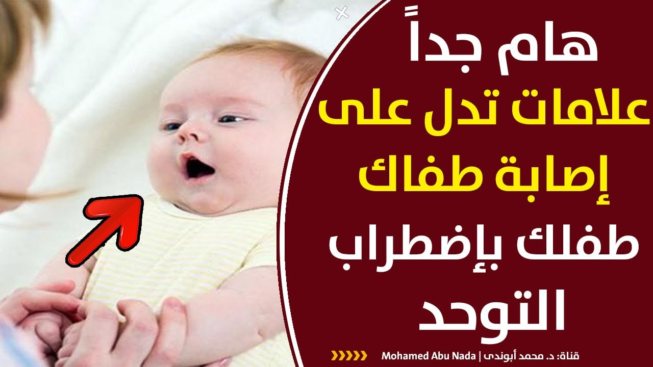 علامات التوحد المبكرة عند الاطفال الرضع من عمر ٦ شهور حتي عمر سنتين | هام جدا