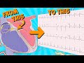 12 lead ecg electrocardiogram for beginners 