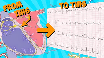 12 Lead ECG (Electrocardiogram) for beginners 🔥🤯.