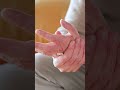 5 señales de DOLOR NEUROPÁTICO