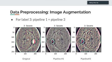 Diabetic Retinopathy Detection