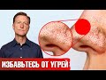 Достали комедоны? Исключи эти продукты и угри пройдут навсегда🙌