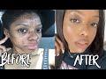 AFRICAN BLACK SOAP DIY LIQUID  | HOW I CLEARED MY ACNE and ECZEMA