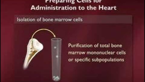 Stem Cells and the End of Aging Part 5 of 6