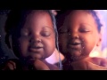 Cadbury | Triplets