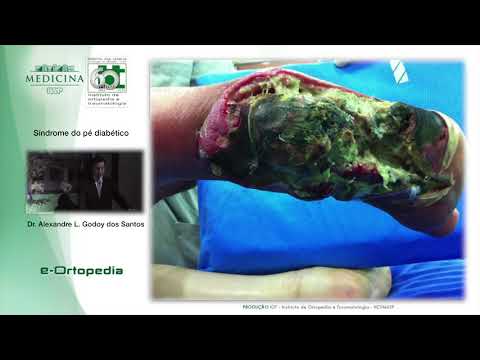 Vídeo: Gangrena Da Perna Com Diabetes Mellitus - Sintomas E Tratamento