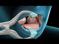 Tonsillectomy & Adenoidectomy | Nucleus Health