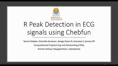 R Peak Detection in ECG signals using Chebfun