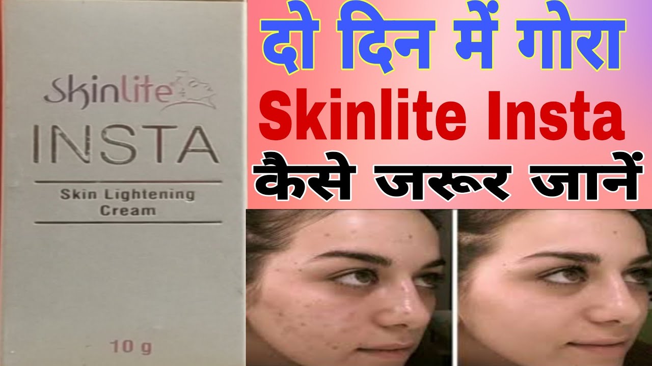Skinlite Insta | Skin Lightening Cream | skin lightening cream for face