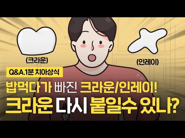 밥먹다가 크라운이 빠졌어요! 인레이 레진 등 보철물 빠짐 다시 붙일 수 있나요?