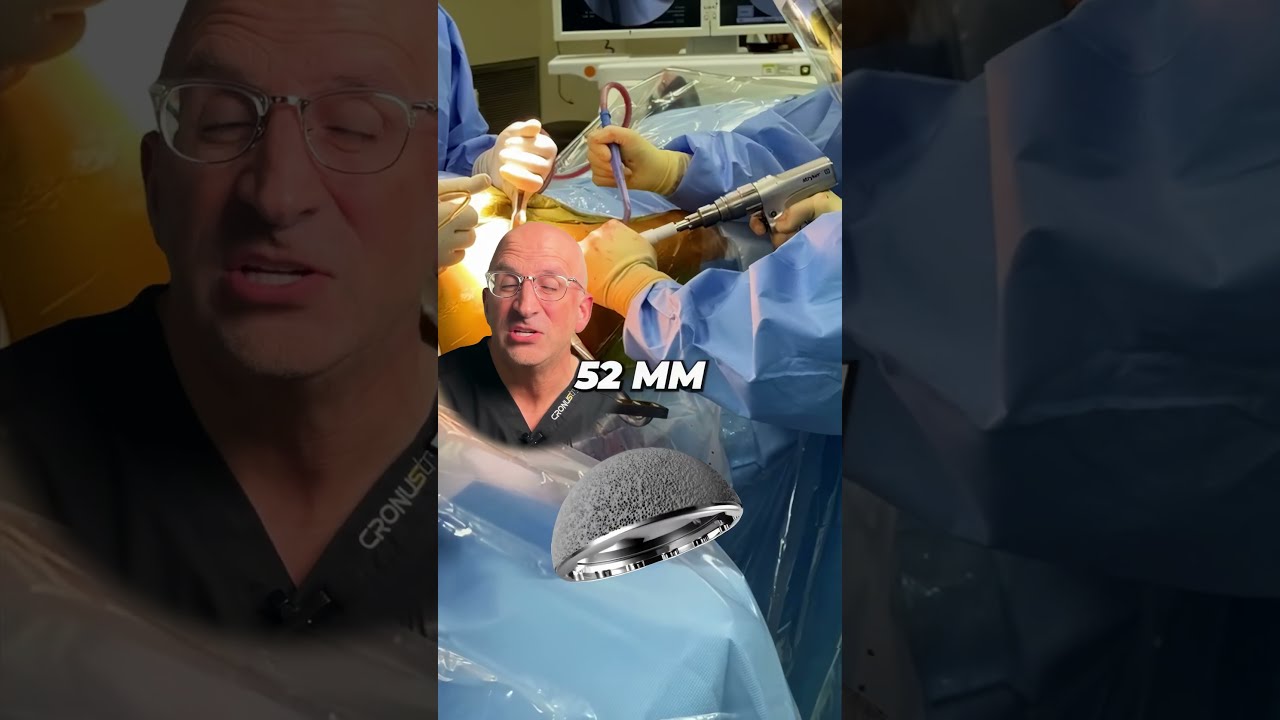 How Does A Hip Replacement Stay In Place Pressfit Implants Shorts