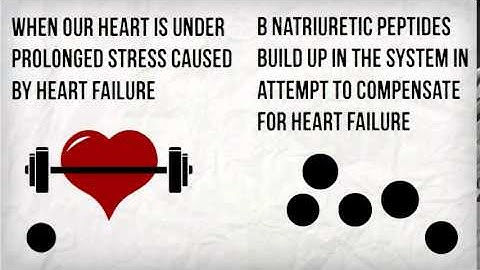 BNP and Heart Failure