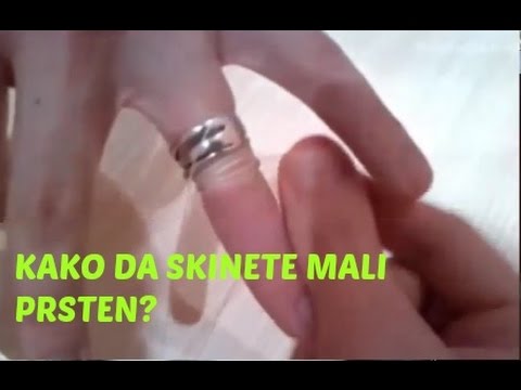 Kako skinuti mali prsten? (Kucni Trikovi)