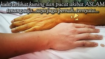 KULIT TERLIHAT KUNING DAN PUCAT AKIBAT ASLAM