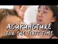 MY FIRST TIME - ACUPUNCTURE #EP2