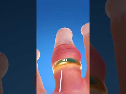 ماذا تفعل اذا علق الخاتم في اصبعك ستجد الحل في هاذا الفديو