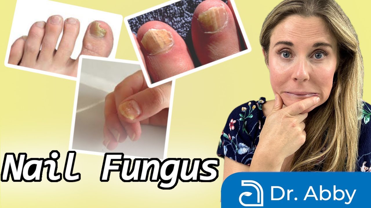 Laser Treatment for Nail Fungus – What You Need to Know | Foot & Ankle