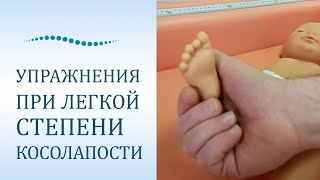 Упражнения при легкой степени косолапости