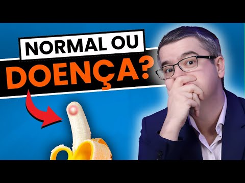 ESPINHAS NO PÊNIS É NORMAL? O QUE FAZER?