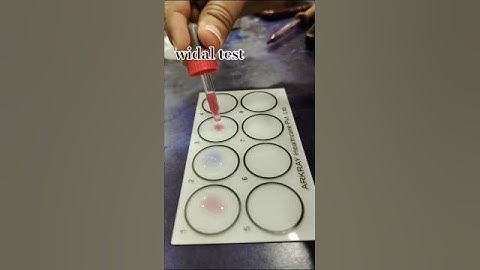 Widal test #laboratory #science #medlab #lab #immunology #widaltest #laboratorytechniques #shorts