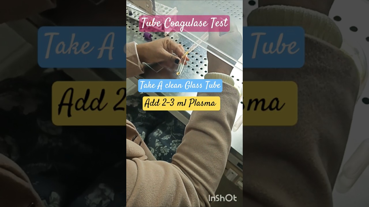 Tube Coagulase Test | Procedure Staphylococcus  